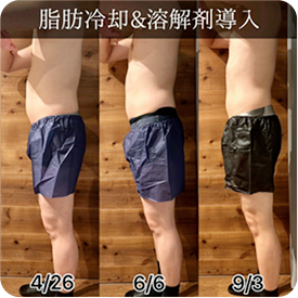 4/26と6/6と9/3の比較