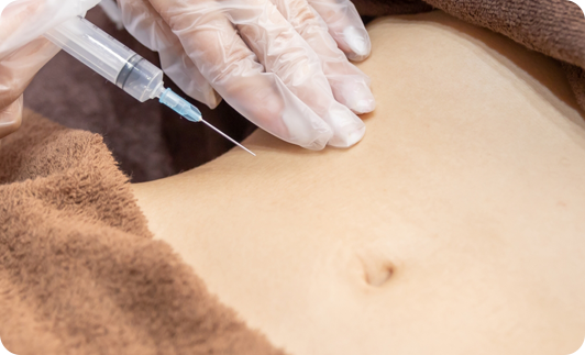 エクソソーム注射